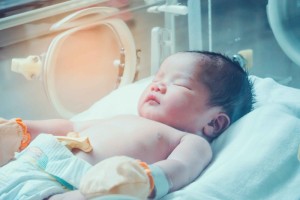 新生儿黄疸该怎么办妈妈必知的宝宝黄疸常识